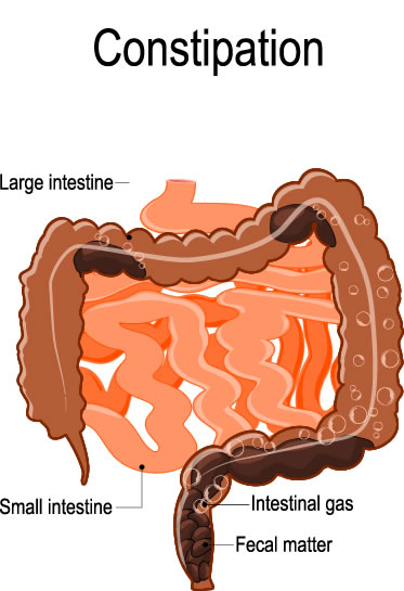 THIS Vitamin Can FIX Years of Chronic CONSTIPATION