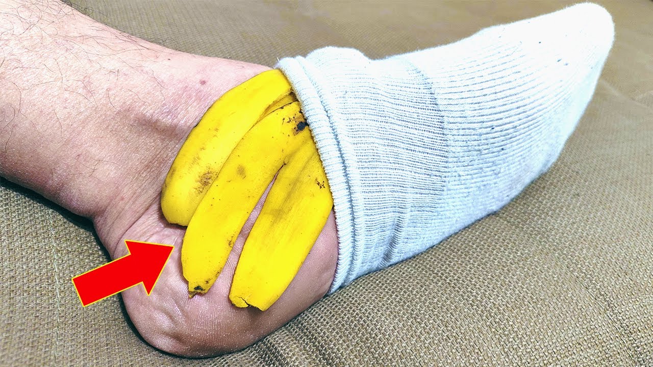 Put banana peel on your feet and don’t spend more at the pharmacy (Did you know that?)