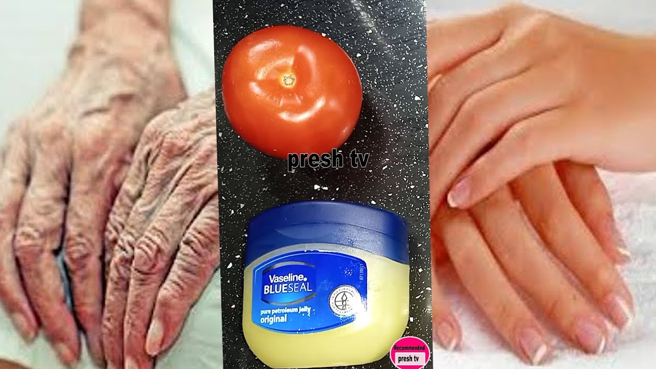 Achieve Soft, Wrinkle-Free Hands with Vaseline and Tomato