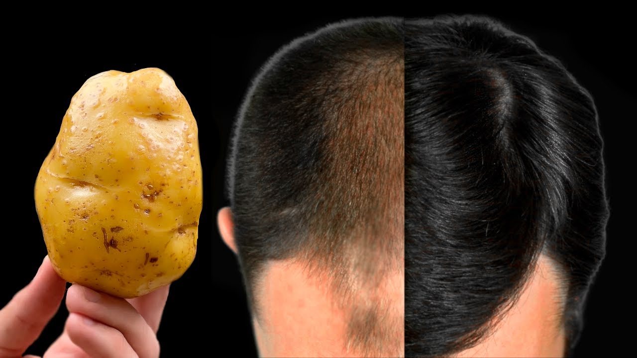 Hair Grows Like Crazy and Doesn’t Fall Out! The Most Powerful Tool: Potato