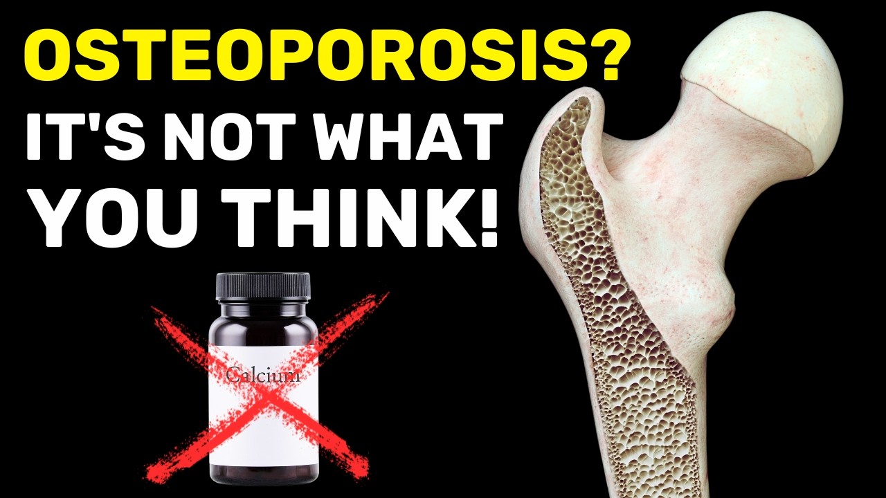 The Hidden Cause of Osteoporosis (It’s Not Calcium Deficiency!)