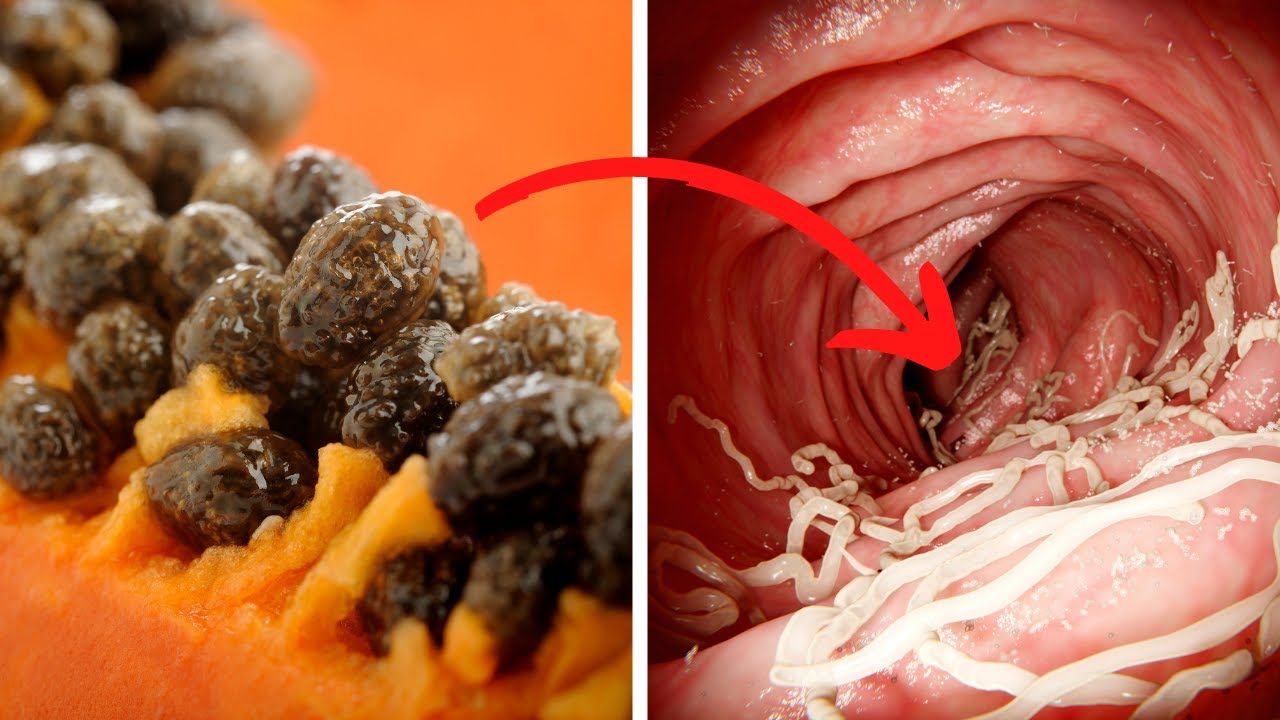 How to Banish Parasites with Papaya Seeds: A Natural Remedy