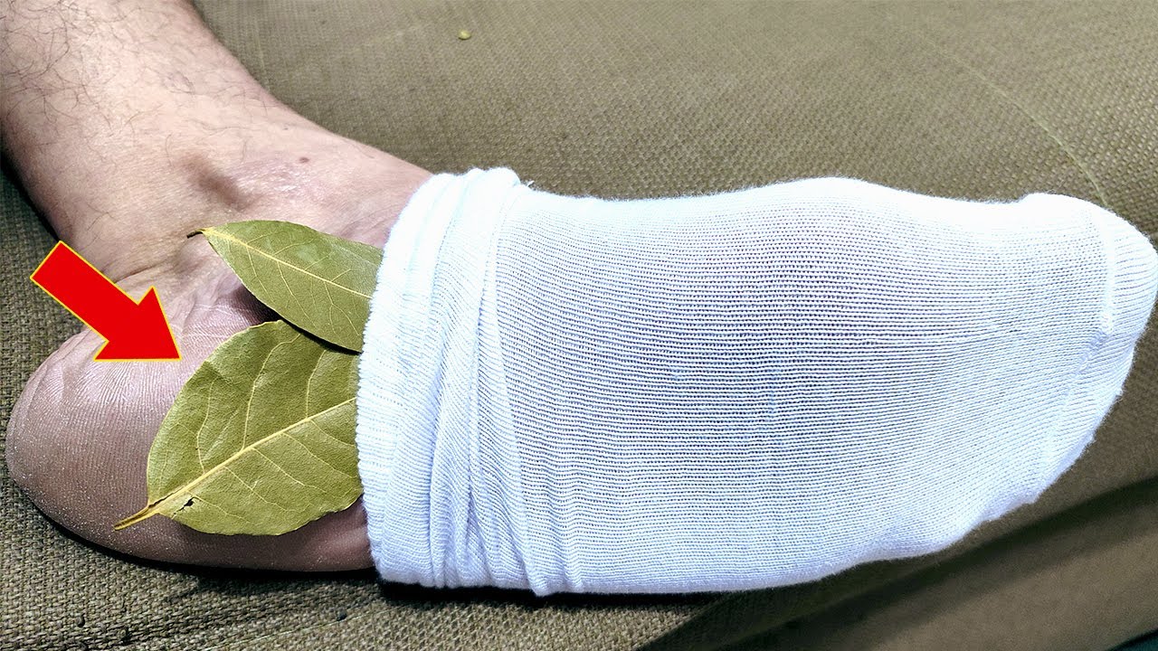 The Surprising Benefits of Bay Leaves for Foot Health