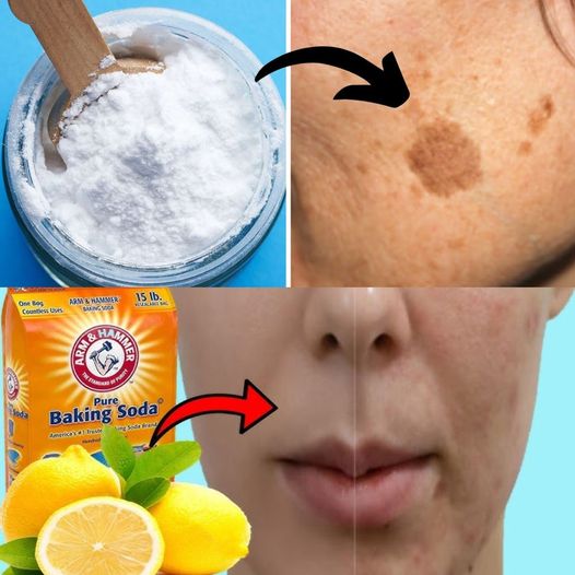 Baking Soda: Your Secret Weapon for Beautiful Skin