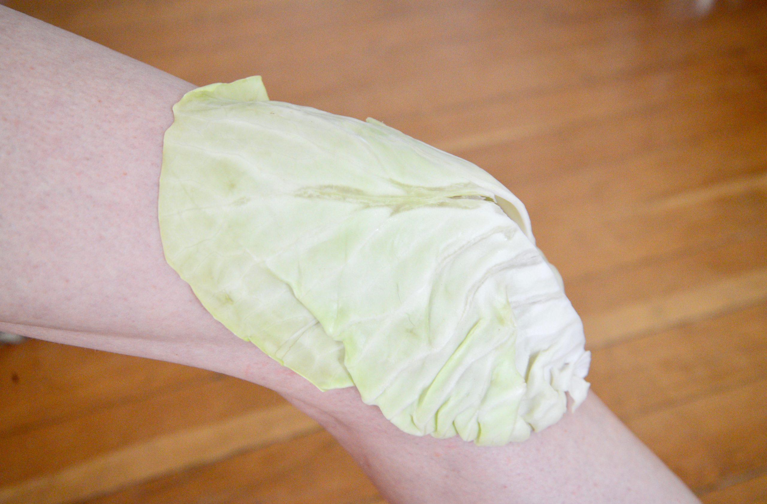 The Benefits of Cabbage Leaves on the Knee for Osteoarthritis