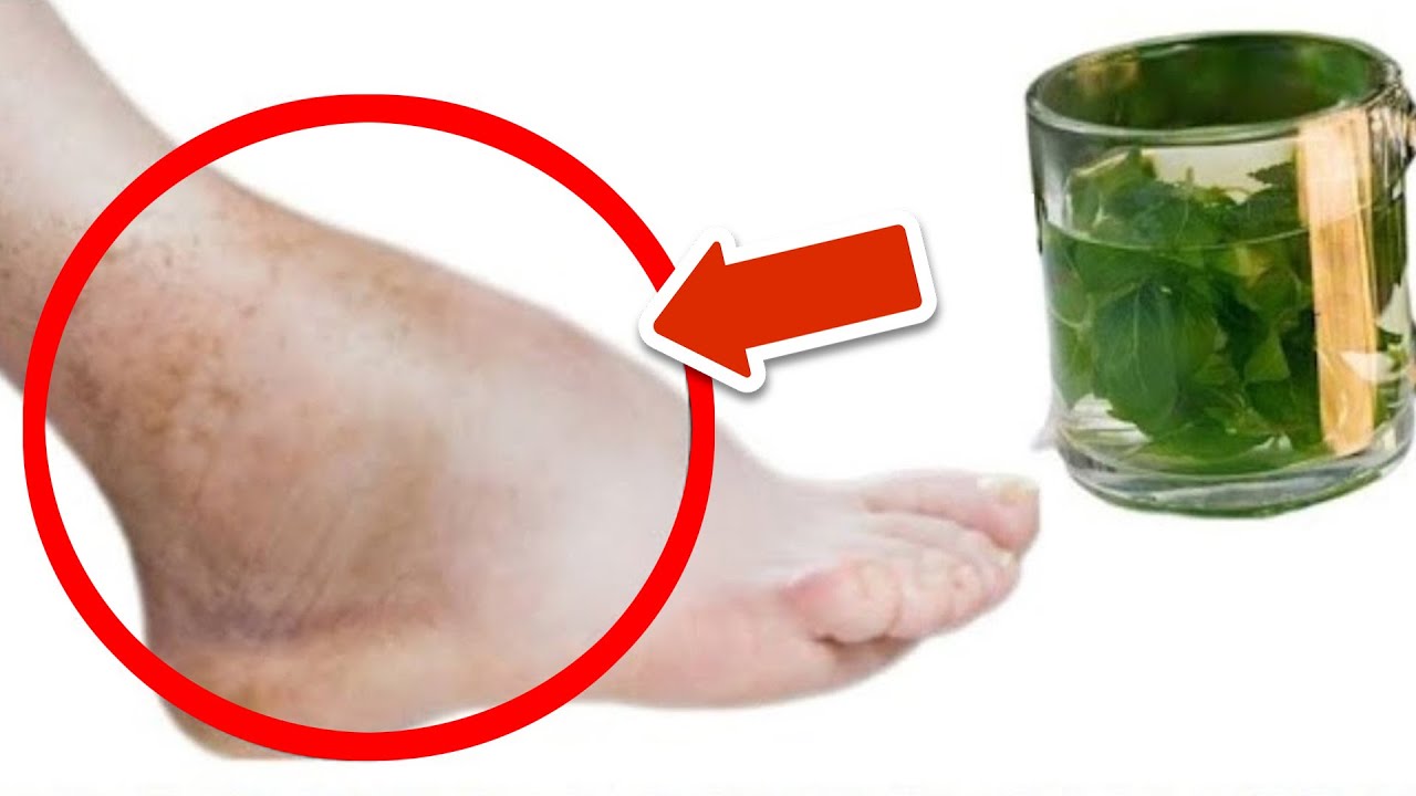 Parsley Tea: A Natural Remedy for Reducing Swelling in Feet and Legs