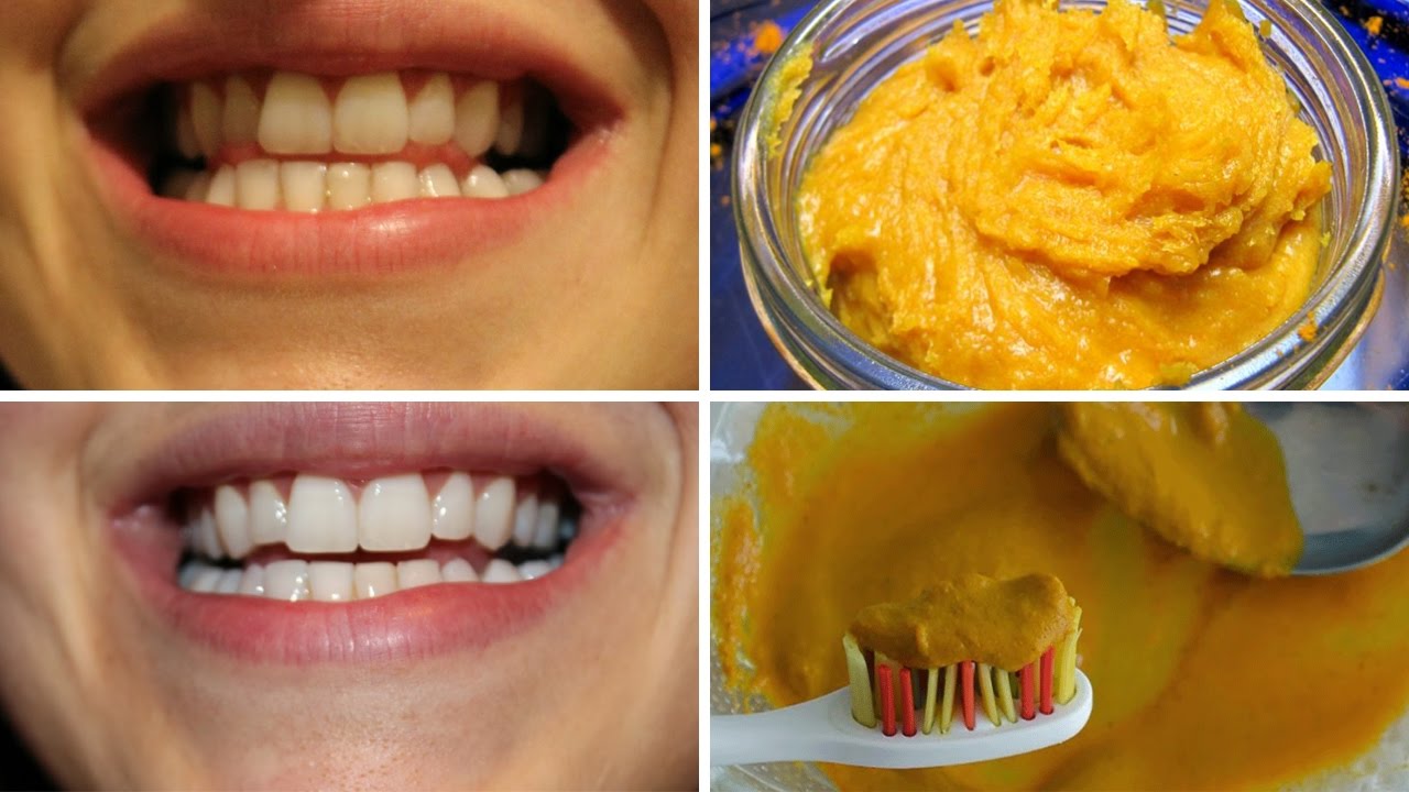 How to Naturally Whiten Your Teeth at Home with Homemade Turmeric Toothpaste