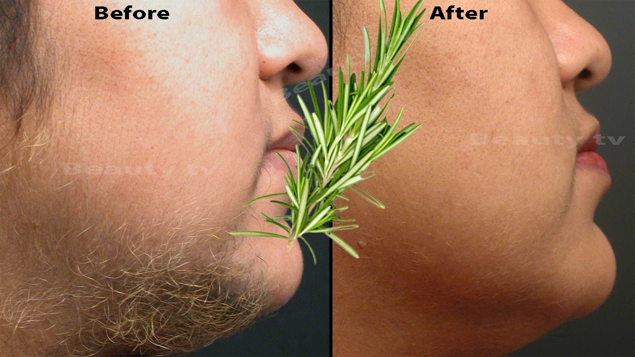 Stop Shaving! Here’s How to Permanently Get Rid of Facial, Body, and Pubic Hair with Rosemary