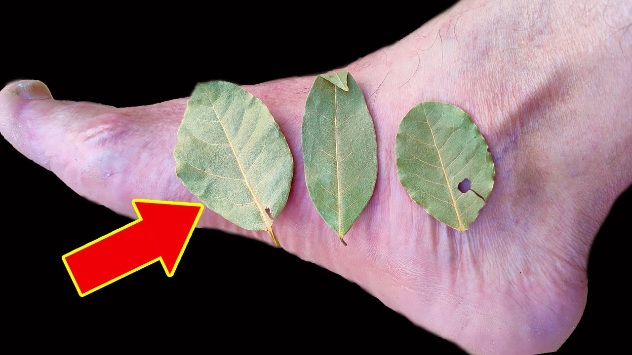 Discover the Benefits of Bay Leaf for Your Feet: A Natural Remedy