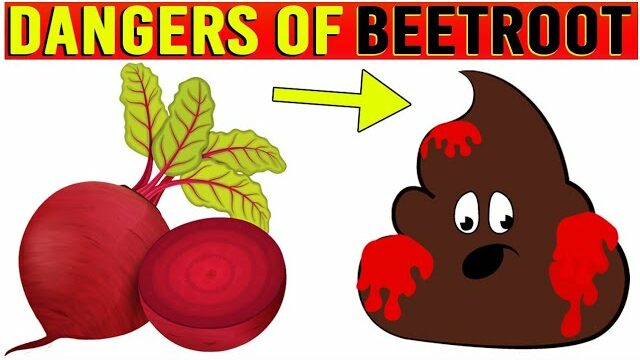 7 Side Effects of Beetroot: Must Know Before Including It in Your Diet