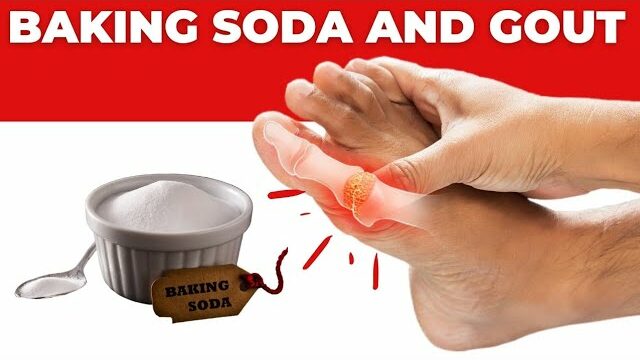 Baking Soda Miracle: Natural Relief from Gout and Kidney Stones