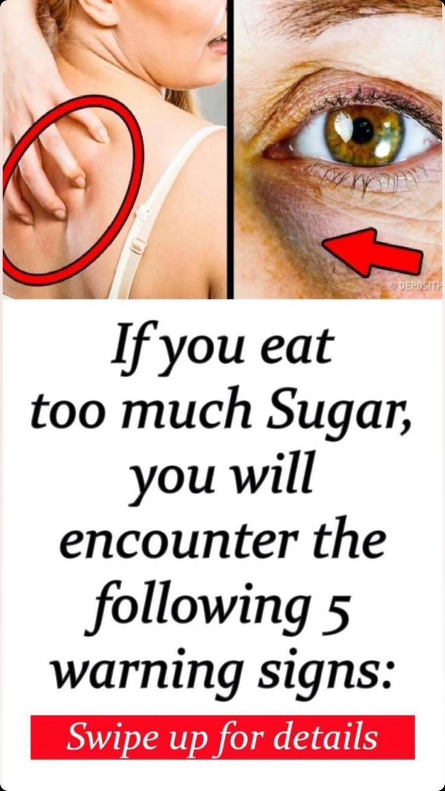 Signs You’re Eating Too Much Sugar