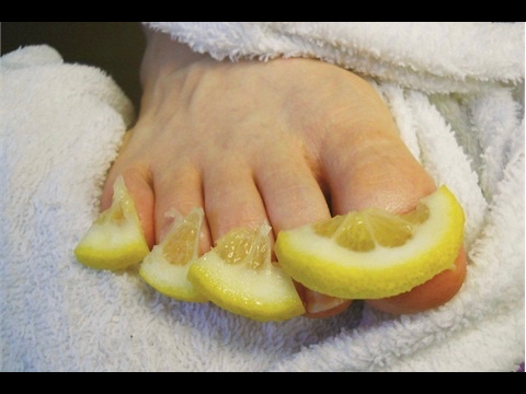 This Will DESTROY Toenail Fungus for Good: Lemon Peels