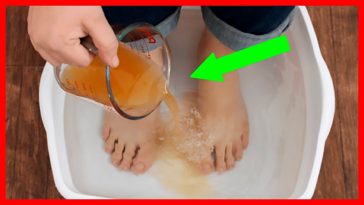 Revive Tired Feet and Eliminate Toxins With This DIY Foot Detox Soak Using Vinegar