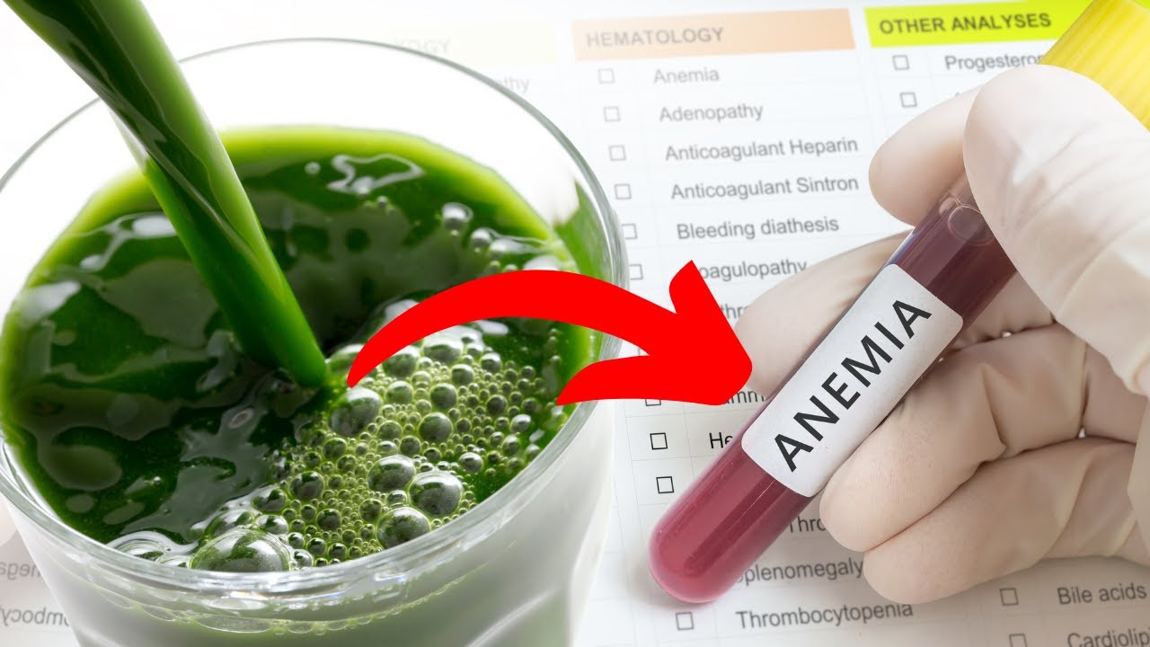 Feeling Weak and Tired? Fight Anemia Naturally With This Powerful Juice!