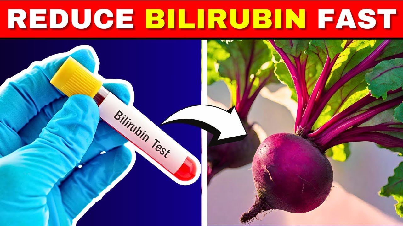 Reduce Bilirubin Levels Quickly with These 5 Superfoods 🌱