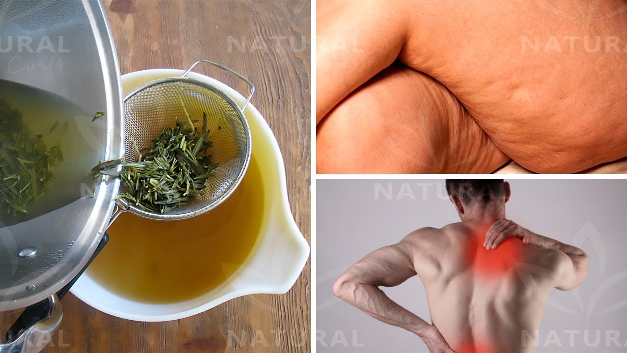 Eliminate Muscle Pain and Cellulite With Rosemary Alcohol