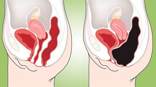How to Cleanse Your Colon Naturally at Home