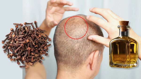 The Power of Clove Oil