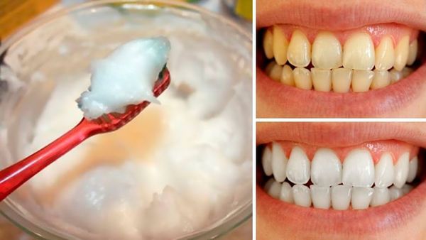 How to Naturally Whiten Your Teeth at Home in Just 3 Minutes Using Baking Soda and Coconut Oil