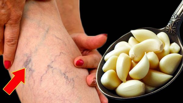 Check out the benefits of Garlic