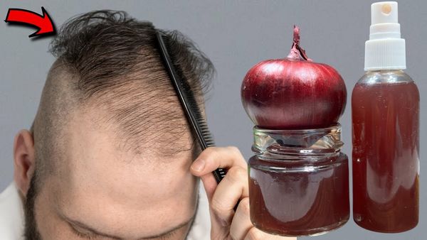 I’m Shocked! With the Help of This Ingredient, Hair on My Bald Spot is Growing Like Crazy!