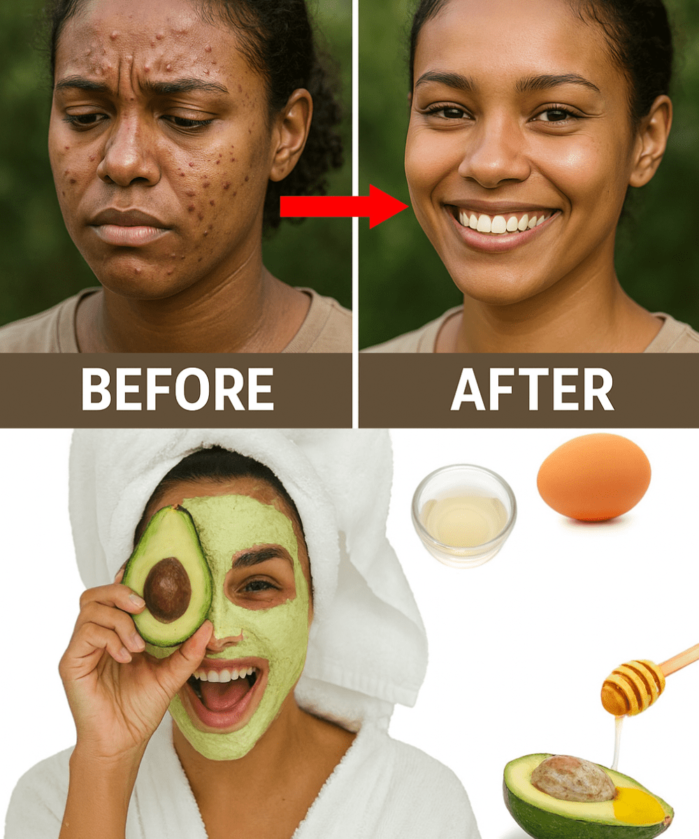 Egg White Magic Banish Blackheads Naturally with One Simple Ingredient